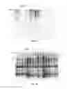 Fig. 09 - CARIES RISK TEST FOR PREDICTING AND ASSESSING THE RISK OF DISEASE