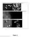 Fig. 05 - MOSQUITOCIDAL XENORHABDUS, LIPOPEPTIDE AND METHODS