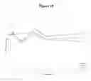 Fig. 16 - RECOMBINANT FVIII FORMULATIONS
