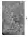 Fig. 09 - Sprayable Hemostat Using Soluble Oxidized Cellulose With Miniaturized Electrospray System And Method