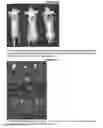 Fig. 04 - Methods of manufacture of pteroyl-amino acid-fluorescent dyes