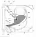 Fig. 01 - Medical device and method for delivering an implant