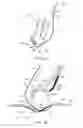 Fig. 06 - Medical device and method for delivering an implant
