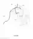 Fig. 09 - Medical device and method for delivering an implant