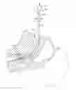 Fig. 01 - Imaging stylet for intubation