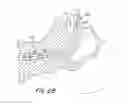 Fig. 08 - Imaging stylet for intubation