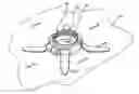 Fig. 01 - Micro-orifice surgical access system