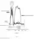 Fig. 02 - Neuromechanical algometer