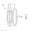 Fig. 04 - Implantation and antenna orientation of an implantable sensor