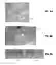 Fig. 09 - In vivo glucose sensing in an increased perfusion dermal layer