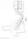 Fig. 06 - Reduce Motion Artifact Electrode