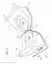 Fig. 06 - Inflatable medical interfaces and other medical devices, systems, and methods