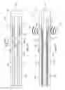 Fig. 03 - IMAGING GUIDEWIRE WITH PRESSURE SENSING