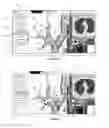 Fig. 08 - TREATMENT PLANNING FOR LUNG VOLUME REDUCTION PROCEDURES