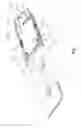 Fig. 02 - MRI COIL DRAPE AND METHOD OF USING
