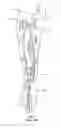 Fig. 06 - Side lumen reentry catheters and related methods