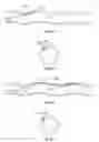 Fig. 08 - Side lumen reentry catheters and related methods