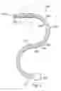Fig. 03 - Shape sensor systems for tracking interventional instruments and mehods of use