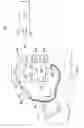 Fig. 06 - Shape sensor systems for tracking interventional instruments and mehods of use