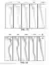 Fig. 09 - Method and system to facilitate intraoperative positioning and guidance