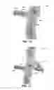 Fig. 12 - Method and system to facilitate intraoperative positioning and guidance
