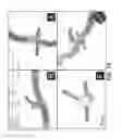 Fig. 13 - Method and system to facilitate intraoperative positioning and guidance