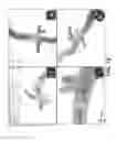 Fig. 14 - Method and system to facilitate intraoperative positioning and guidance