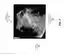 Fig. 08 - Systems and Methods to Detect and Present Interventional Devices via Ultrasound Imaging