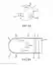 Fig. 08 - Force-sensing ablation catheter