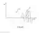 Fig. 09 - Force-sensing ablation catheter
