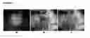 Fig. 09 - Imaging system and method for fluorescence guided surgery