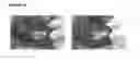 Fig. 12 - Imaging system and method for fluorescence guided surgery
