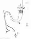 Fig. 07 - DEVICES AND METHODS FOR IMAGING AND CROSSING OCCLUDED VESSELS
