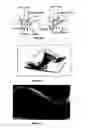 Fig. 02 - Endorectal prostate probe with combined PET and US modalities
