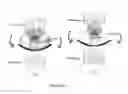 Fig. 02 - PET Imaging With Partially Radiation-Transparent Probes-Inserts
