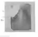 Fig. 02 - PEDIATRIC ORAL DELIVERY DEVICE AND RELATED METHOD