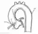 Fig. 01 - DELIVERY CATHETER HAVING EXPANDABLE ELEMENTS