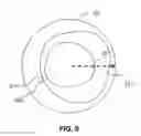 Fig. 06 - DEFLECTABLE IVUS CATHETER