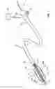 Fig. 02 - Quantification of renal denervation via alterations in renal blood flow pre/post ablation