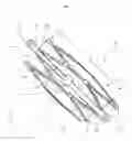 Fig. 02 - Implantable device with bridge