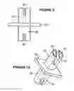 Fig. 09 - Multi-lumen breathing tube device