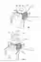 Fig. 03 - Graft Cartilage Management Systems and Methods