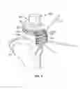 Fig. 04 - Graft Cartilage Management Systems and Methods