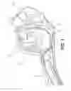 Fig. 02 - Treating sleep apnea with negative pressure