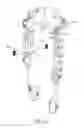 Fig. 30 - Transmission assembly for use in an exoskeleton apparatus