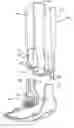 Fig. 01 - Modular system for an orthopedic walking boot