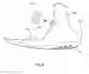 Fig. 09 - Overmolding for an orthopedic walking boot