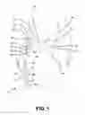 Fig. 02 - Extension Limiting Strap for a Hip Brace