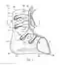 Fig. 02 - Ankle foot orthosis (AFO) and method of making the same