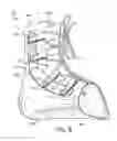 Fig. 07 - Ankle foot orthosis (AFO) and method of making the same